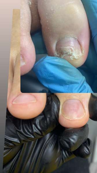 Подолог в Краснодаре фото 3