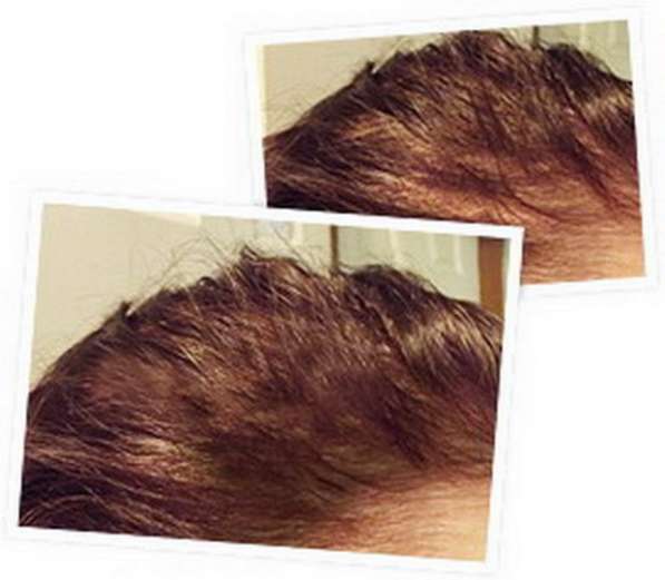 Спрей для восстановления и роста волос Ultra Hair Spray Syst в Москве фото 13