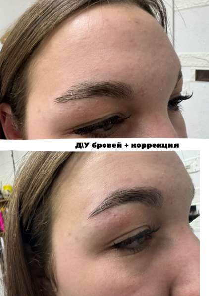 Брови, ресницы