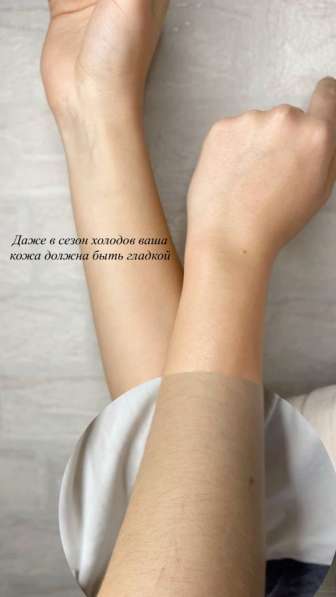 Депиляция шугаринг