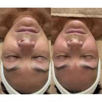 Скульптурный лифтинг массаж, в Санкт-Петербурге